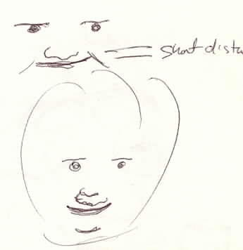 Down's Syndrome Sketch